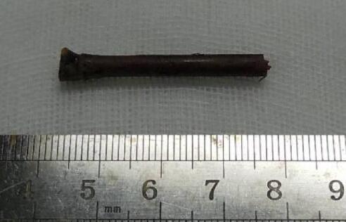 “小小竹棍把我害的好苦啊!幸好，遇到了厦门眼科中心眼整形科的胡继发副主任。医术好、态度好。大医院 医生就是不一样!”——医治眼睛后的老李激动的说道2.jpg