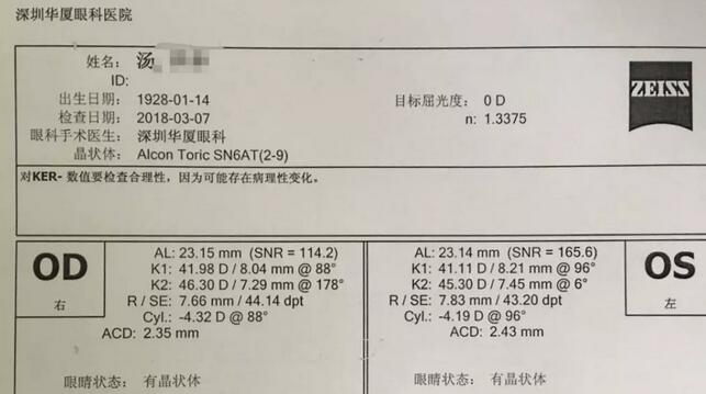 3月12日下午，已经90高龄的离休东江纵队老兵汤爷爷，在深圳华厦眼科医院检查之后，白内障专科邢宝刚主任为其实施左眼白内障超声乳化摘除，联合散光人工晶体植入术。2.jpg