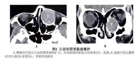 4月7-8日，天津医科大学眼科医院副院长、天津医科大学眼视光学院副院长、中华眼科学会委员、眼整形、眼眶病学组副组长孙丰源教授将莅临福州眼科医院2.jpg