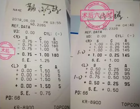 福州眼科医院近视手术取样：视力不差、无法通过参军公考体检群体该怎么办1.png