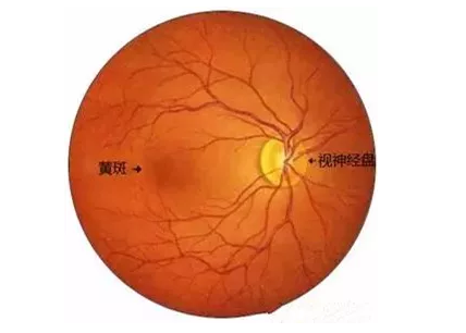 华厦福州眼科医院眼底病医生：老年黄斑变性该如何防治？.png