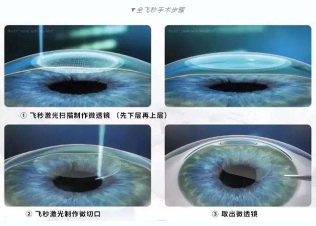 7月26日来深圳华厦眼科医院参与暑期摘镜季活动就可以有机会参与抽奖免单手术！2.png