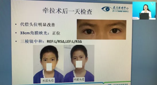高峰论道·云端荟萃 ▏万人同步在线，30余名大咖云集“第六届华厦眼科论坛斜视与小儿眼科新技术学习班暨小儿、眼视光分论坛”7.png
