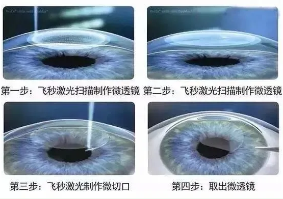 2021年征兵准备工作已经全面展开，视力不够的看过来2.png